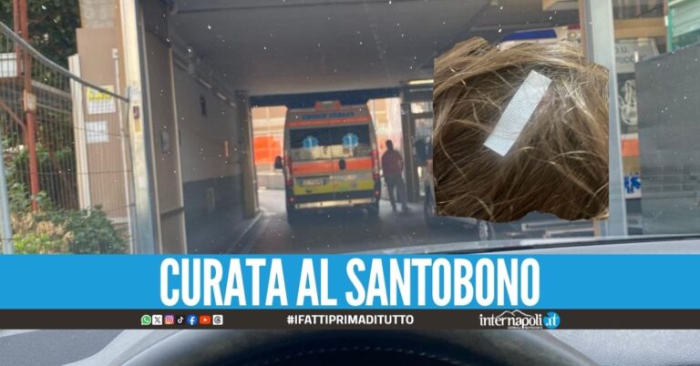 Bimba cade in casa ad Ercolano, i carabinieri