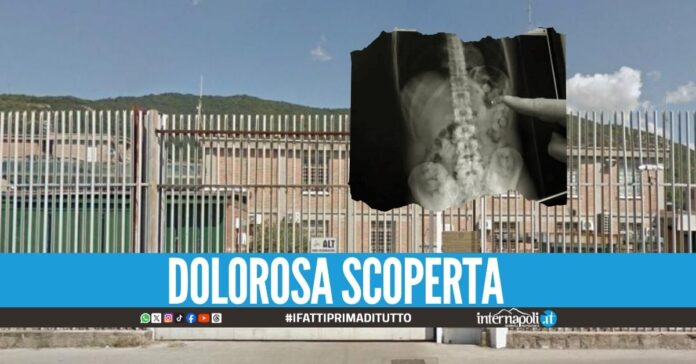 Si nasconde la cocaina nel retto, detenuto beccato a Salerno