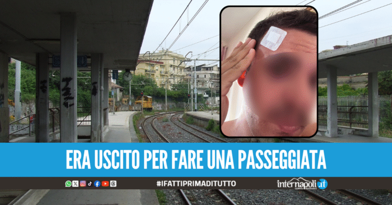 Vergogna a Ottaviano, ragazzo disabile preso a sassate dalla baby-gang