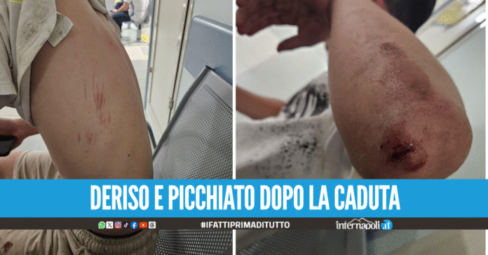 Violenza nel Napoletano 14enne aggredito dal branco per una caduta dalla bici
