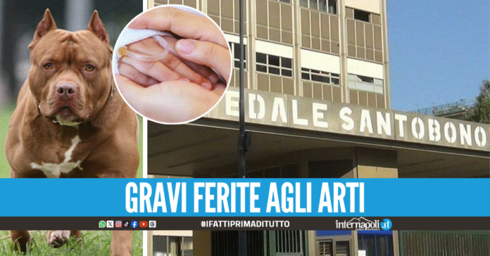Bimbo di 9 anni azzannato da un pitbull, ricoverato d'urgenza al Santobono