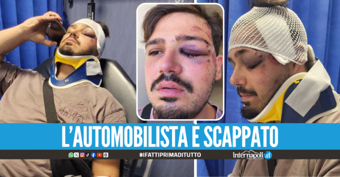 Paura a Napoli, ciclista investito da un pirata della strada nella Galleria Vittoria