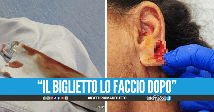 Paura sull'autobus a Napoli, non paga il biglietto e picchia il controllore