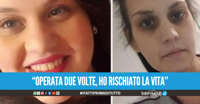 Ridotta in fin di vita dopo l'intervento di bypass gastrico, Angela testimonia in aula contro il suo chirurgo