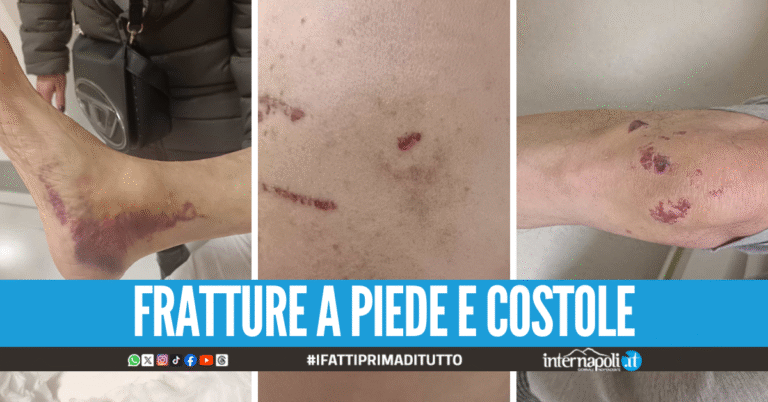 Aggressione choc all'anziano a Napoli, colpito a bastonate mentre portava a spasso il cane