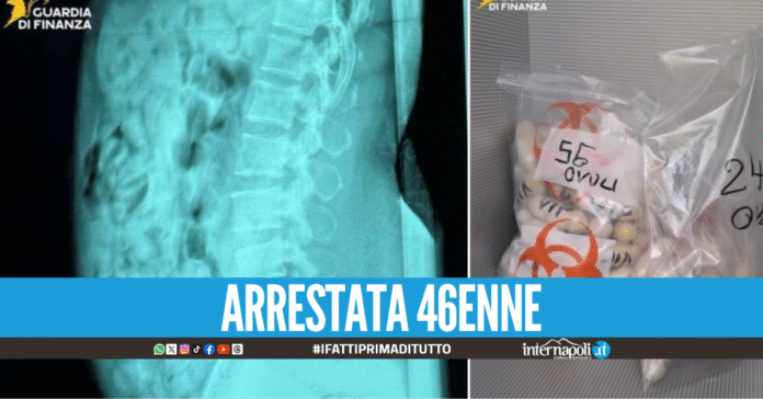 Ingoia 120 ovuli di eroina e tenta di imbarcarsi, aveva 1,4 kg di droga nello stomaco
