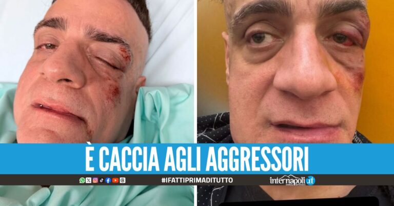 Cicalone aggredito in metro: "Infami, da dietro in dieci contro uno"