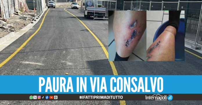 Escalation di incidenti a Fuorigrotta, pedone travolto dallo scooter in corsa