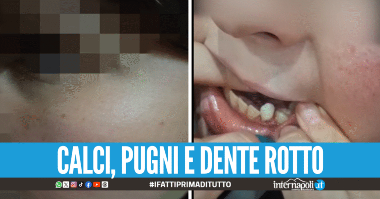 Ragazzino picchiato in piazza a Ercolano, il papà dell'aggressore incitava il figlio alla violenza