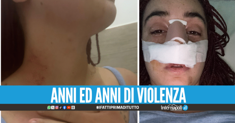Violenza nel Napoletano, picchiata dal compagno fa una videochiamata alla figlia e viene salvata