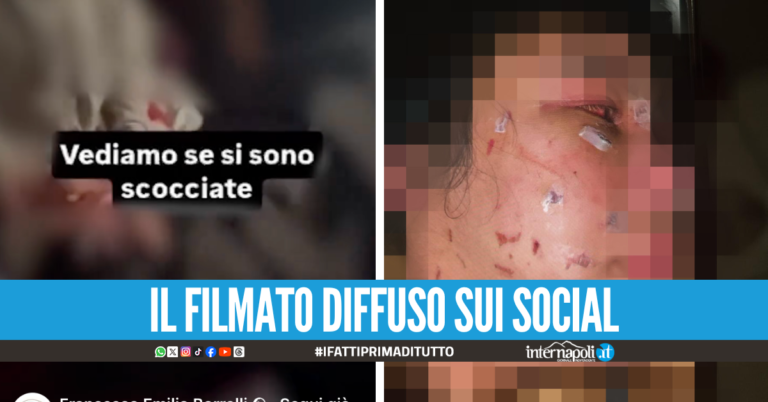 Choc a Napoli, picchiata e seviziata da 5 ragazze dopo la lite in discoteca