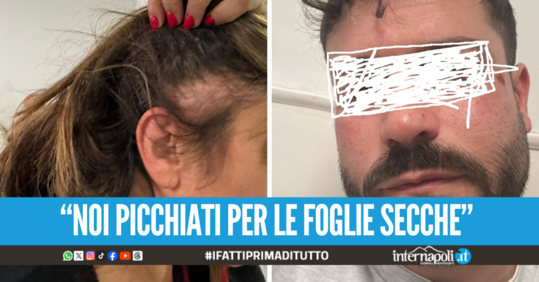 Assurdo a Portici, famiglia aggredita dal branco dopo la lite condominiale