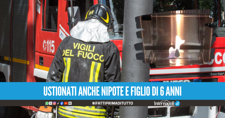 Stufa in fiamme ad Arzano, ustionata intera famiglia: corsa al Cardarelli e Santobono