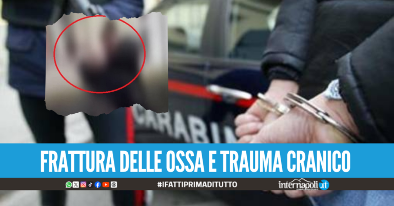 Assurdo a S. Antimo, picchiato a sangue per uno sguardo di troppo