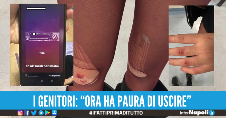 Ragazzina picchiata selvaggiamente in villa comunale a Marigliano da 2 coetanee