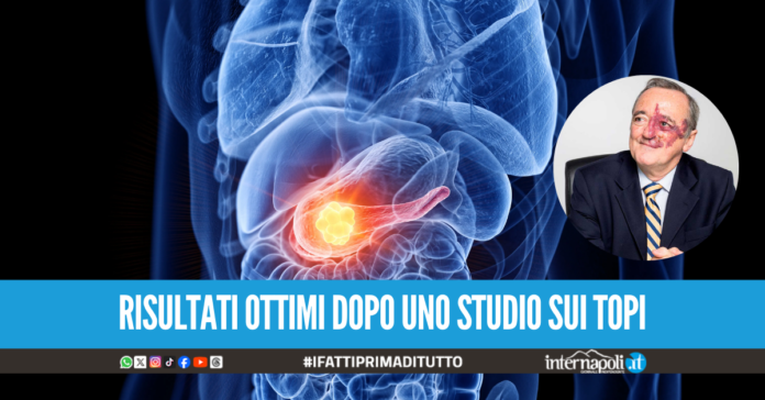 Cancro al pancreas, dalla Spagna una nuova strategia con 3 farmaci dà speranza