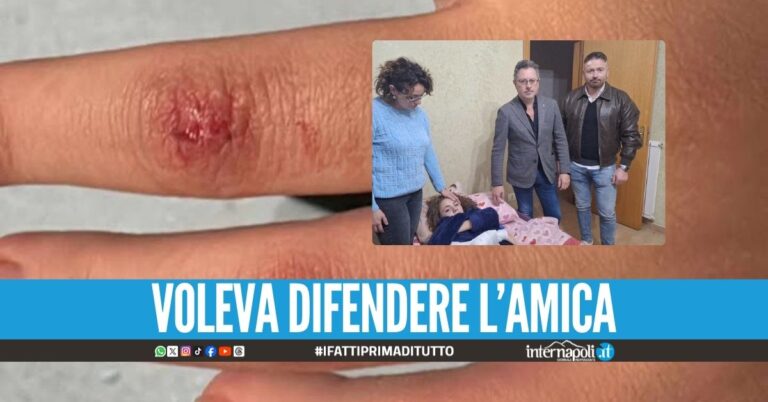 Violenza nel Napoletano, la 15enne Aurora aggredita da 2 coetanee