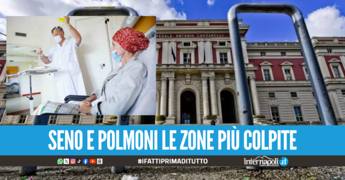 Lotta al cancro, 3mila nuovi pazienti al Cardarelli nel 2025