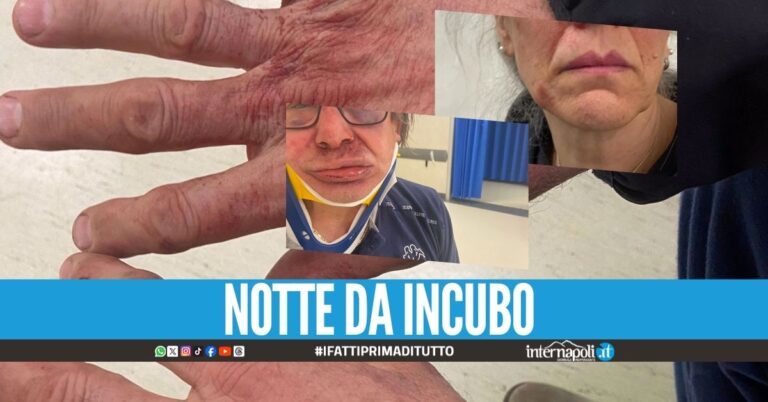 Picchiati e sequestrati in casa a Casoria, le condizioni dei feriti