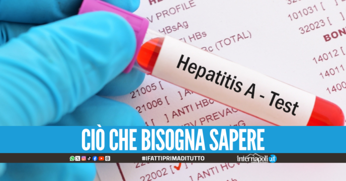 Epatite A: cos'è e come si trasmette: quali sono i sintomi e la cura