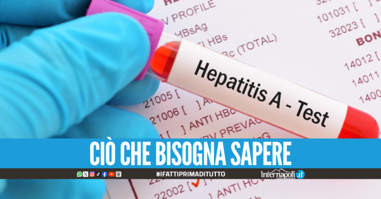 Epatite A: cos'è e come si trasmette: quali sono i sintomi e la cura