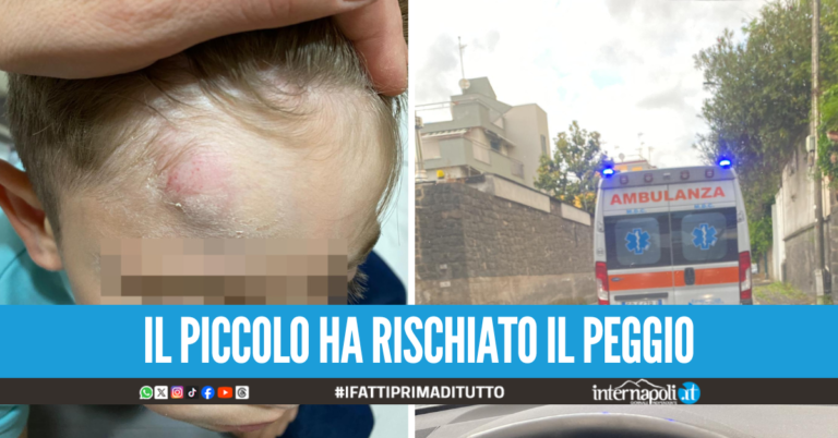 Bimbo cade dalla bici nel Napoletano, salvato grazie alla corsa al Santobono