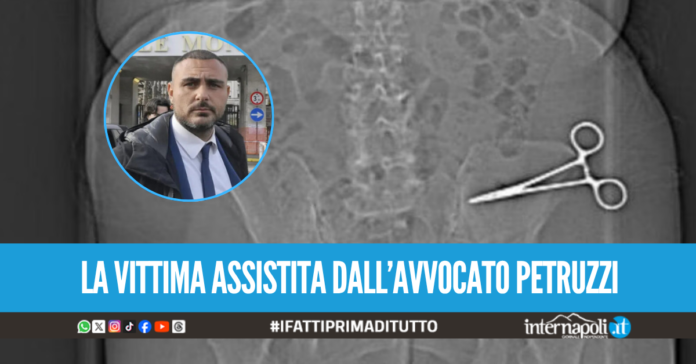 Dimentica le forbici nell'addome di una paziente, denunciato chirurgo a Napoli