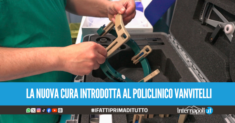 Stop ai tremori da Parkinson senza bisturi, a Napoli pazienti curati col caschetto ad ultrasuoni