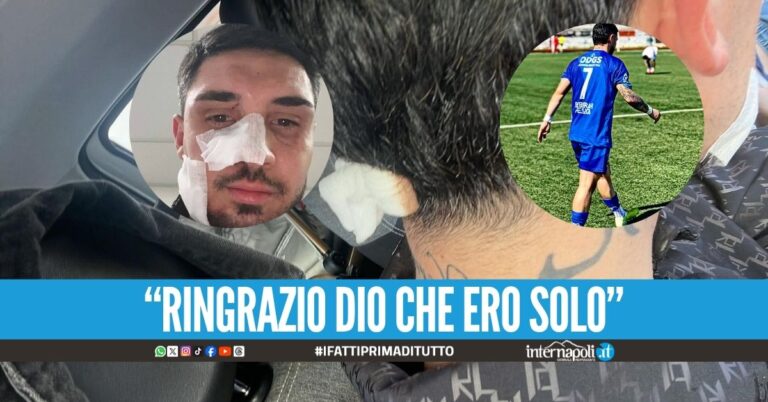 Calciatore del Don Guanella tamponato e pestato sull'Asse Mediano a Casoria