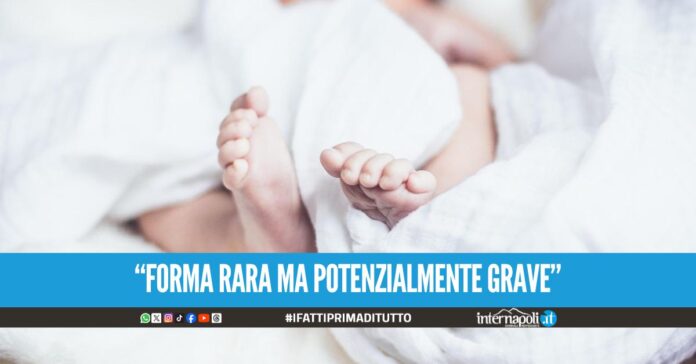 Botulismo ambientale all'ospedale Santobono, risolti 5 casi in 6 mesi