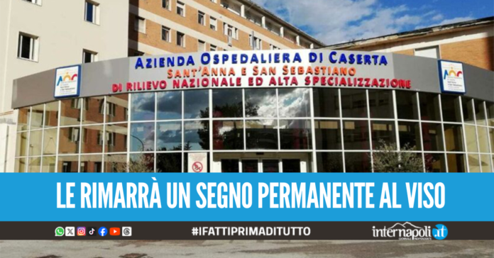 Lancia piatto di ceramica contro la figlia e la sfregia, arrestato papà violento a Caserta