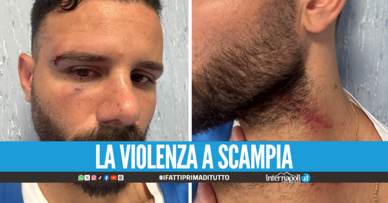 "Stai guardando mia moglie?", Paolo finisce in ospedale per il sospetto del marito geloso