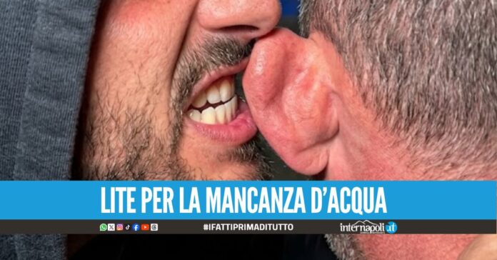 Strappa l'orecchio al proprietario di casa a Villaricca, arriva la condanna soft
