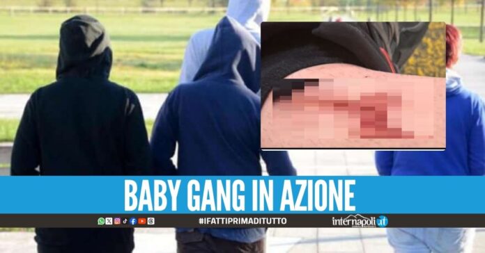 Violenza in strada a Volla, 12enne picchiato dal branco