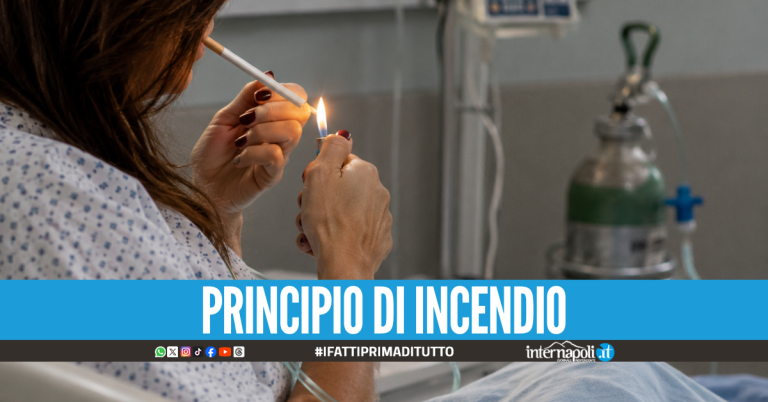 Accende la sigaretta durante l'ossigenoterapia, donna ustionata ad Avellino