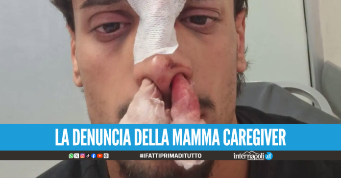 Frattamaggiore, posto disabili occupato abusivamente: 
