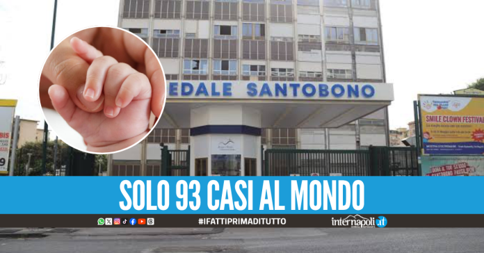 Colpito da una rarissima malattia, neonato salvato al Santobono