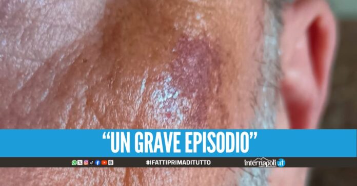Controllare aggredito alla stazione della Circumvesuviana di Napoli, la denuncia del sindacato