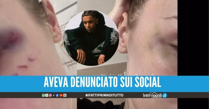 Picchiò l'ex fidanzata, il rapper Faneto condannato a 3 anni di carcere