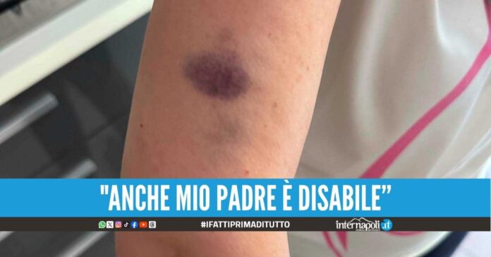 Assurdo a Casoria, picchiata per aver difeso lo stallo per disabili del figlio