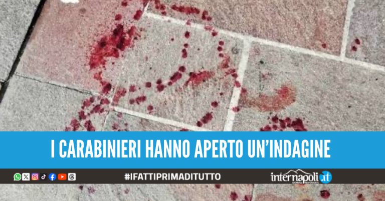 Ancora sangue in strada a Napoli, uomo accoltellato al torace e alla schiena