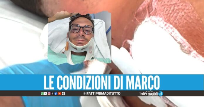 Paura nella vacanza in Brasile, ragazzo napoletano ricoverato dopo il tuffo