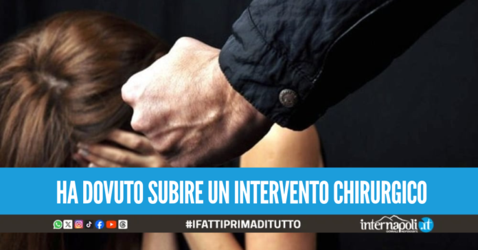 Pugni e schiaffi alla moglie a Melito, la donna salva grazie alle urla strazianti d'aiuto