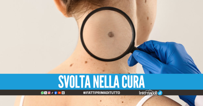 Melanoma, scoperto meccanismo che aiuta il tumore a sfuggire alle cure