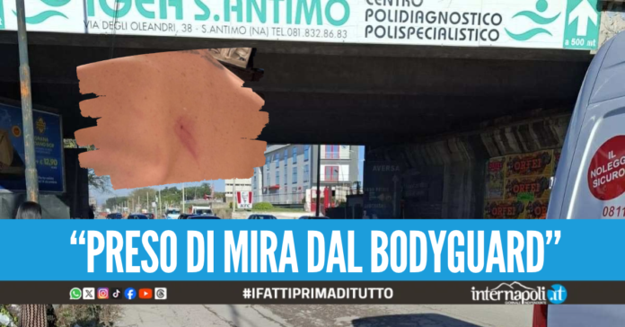 Pestaggio in discoteca a Sant'Antimo, giovane colpito con calci a viso e schiena