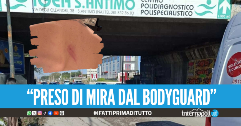 Pestaggio in discoteca a Sant'Antimo, giovane colpito con calci a viso e schiena